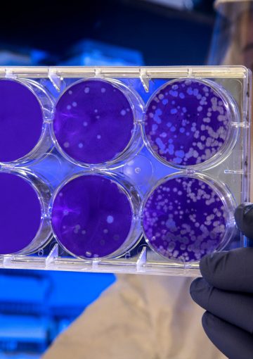 Degrading lysosomal membrane proteins