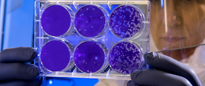 Degrading lysosomal membrane proteins